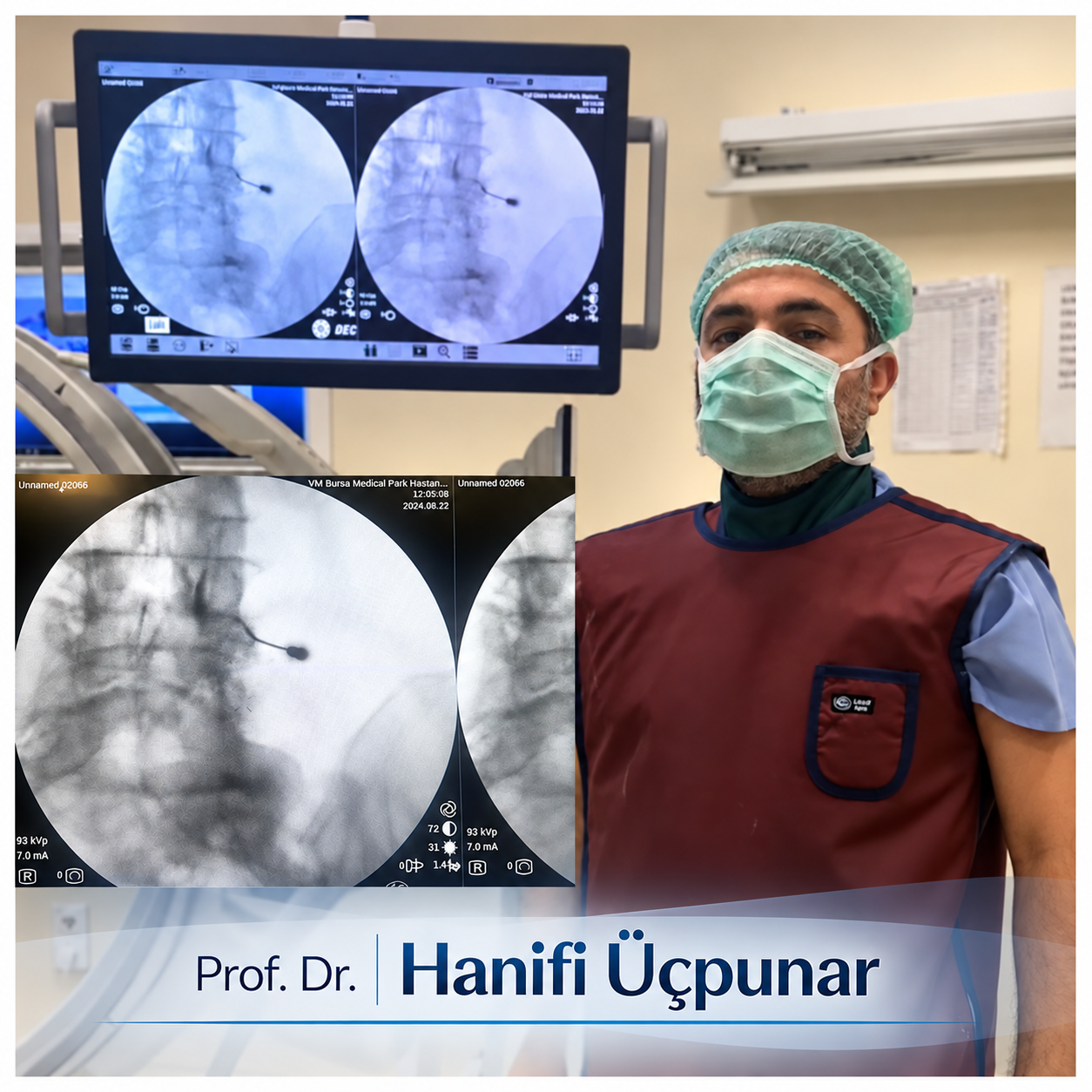 Bel iğnesi algolojik tedaviler - Prof. Dr. Hanifi Üçpunar -Ortopedi ve Travmatoloji